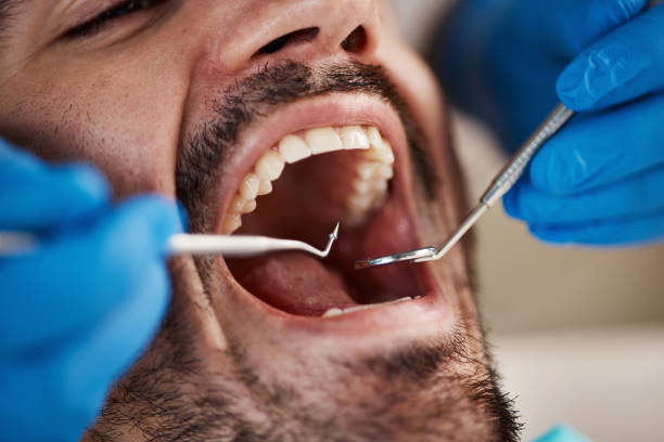 Best Emergency Care for Gum Disease in Caon City, CO