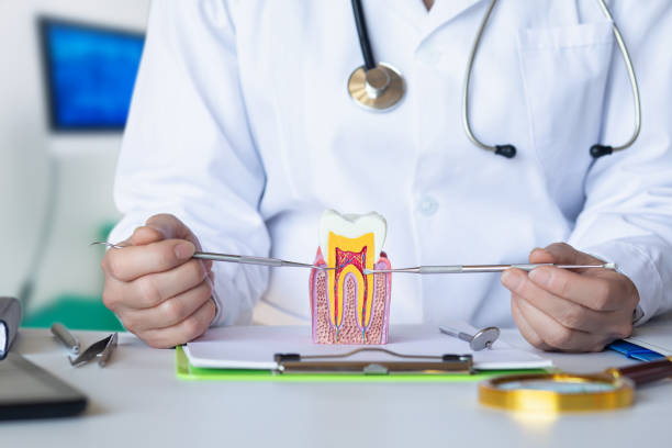 Best Knocked-Out Tooth (Avulsed Tooth) Treatment in Caon City, CO